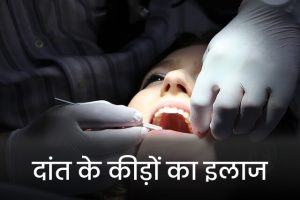 Treatment-of-tooth-worms
