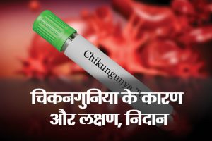 Chikungunya-Symptoms