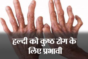 Leprosy