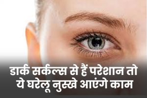 dark-circles